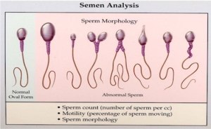 semen-analysis